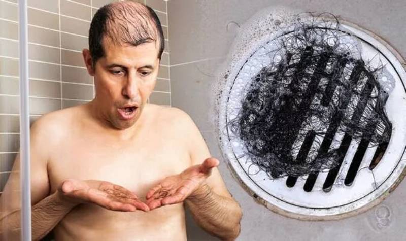 Gội đầu bị rụng tóc, nước bẩn – Cảnh báo cần thận trọng